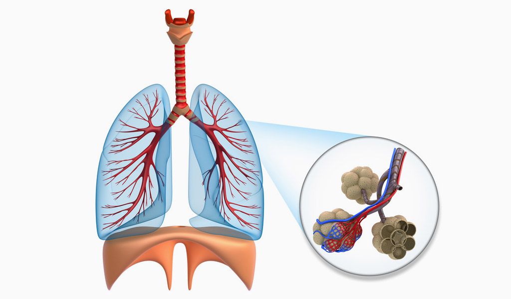 Lungenemphysem - Was ist ein Emphysem? - LEICHTER ATMEN