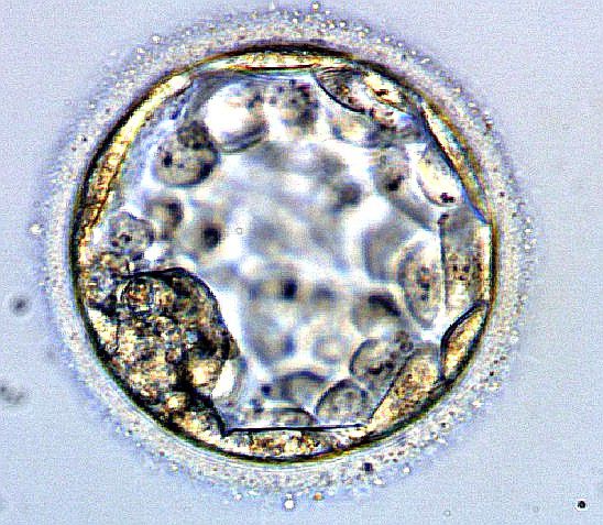 human blastocyst at 5 weeks
