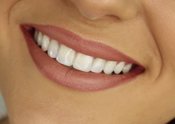 7 Good Habits For Healthy Teeth